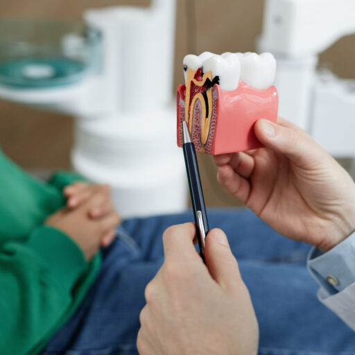 Ballarat Root Canal Treatment