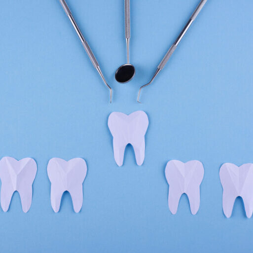 Tooth Extraction Ballarat