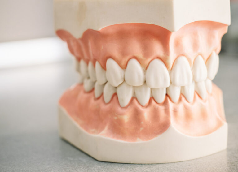 gum disease treatment Ballarat